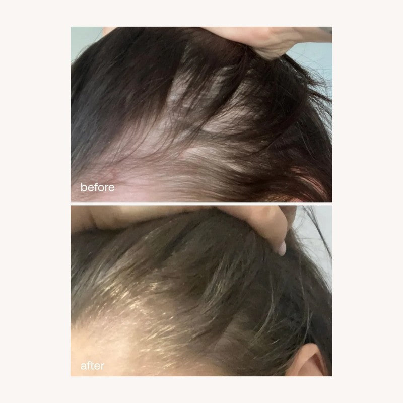 UKLASH HAIR GROWTH SERUM - 50 ML