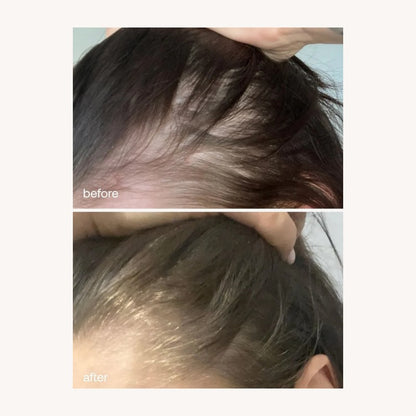UKLASH HAIR GROWTH SERUM - 50 ML