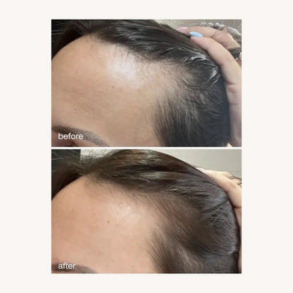 UKLASH HAIR GROWTH SERUM - 50 ML